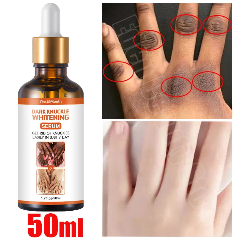 Dark Knuckles Fast Whitening Serum Hand Knuckle Elbows Knee Melanin Corrector Intense Stains Remover Products Beauty Care 50ml